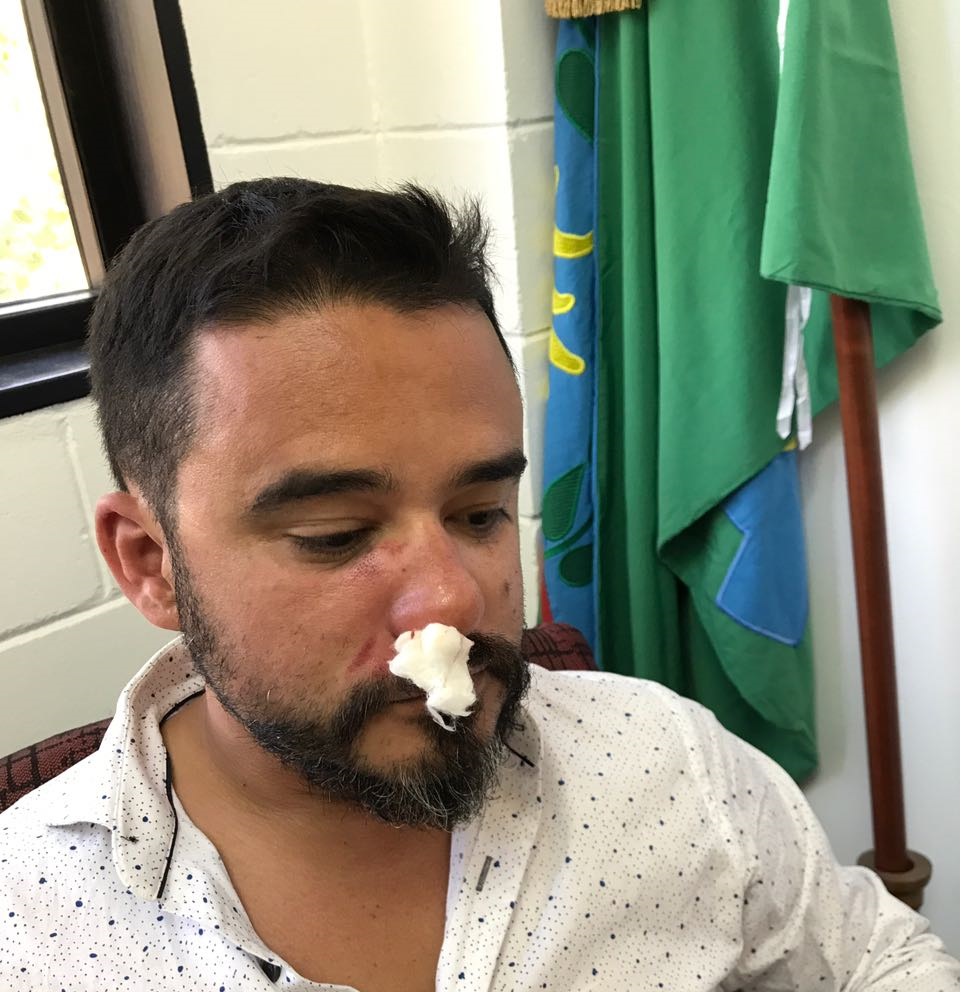 Escándalo en el HCD: golpean a un concejal antes de la sesión