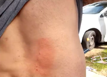 Denuncian una agresión contra militantes de Juntos